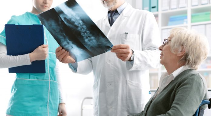 Fragilidad silenciosa Osteoporosis